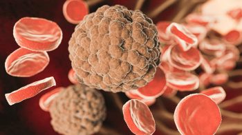 Lymphogranuloma venereum