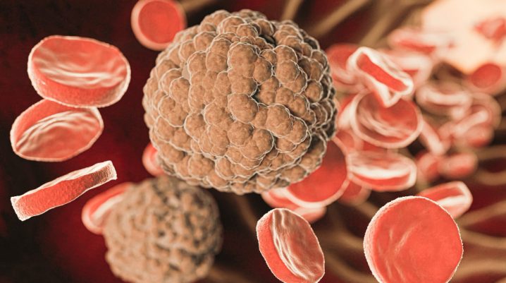 Lymphogranuloma venereum